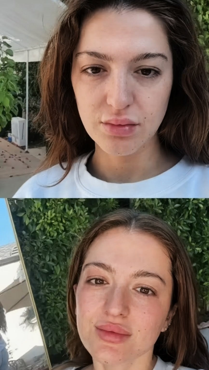 Ice Facial Bowl – Reduce Puffiness in 30 Seconds ❄️